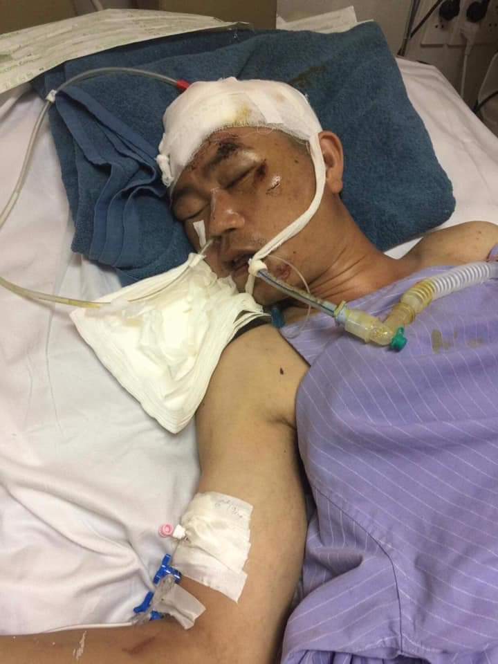 Gia đình anh Đỗ Văn Duệ mong được giúp đỡ